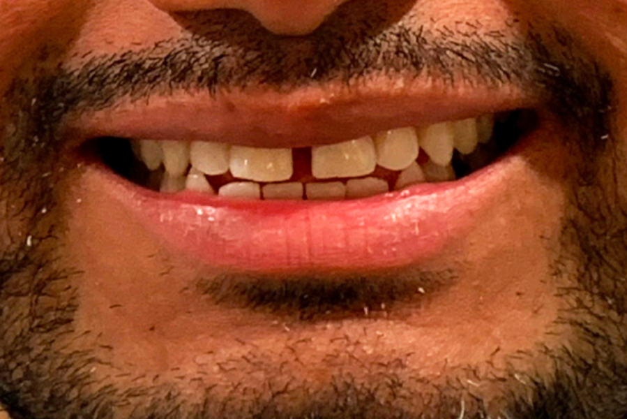 bna-sample