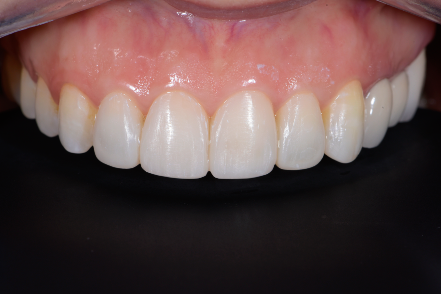 After