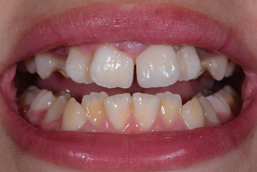After