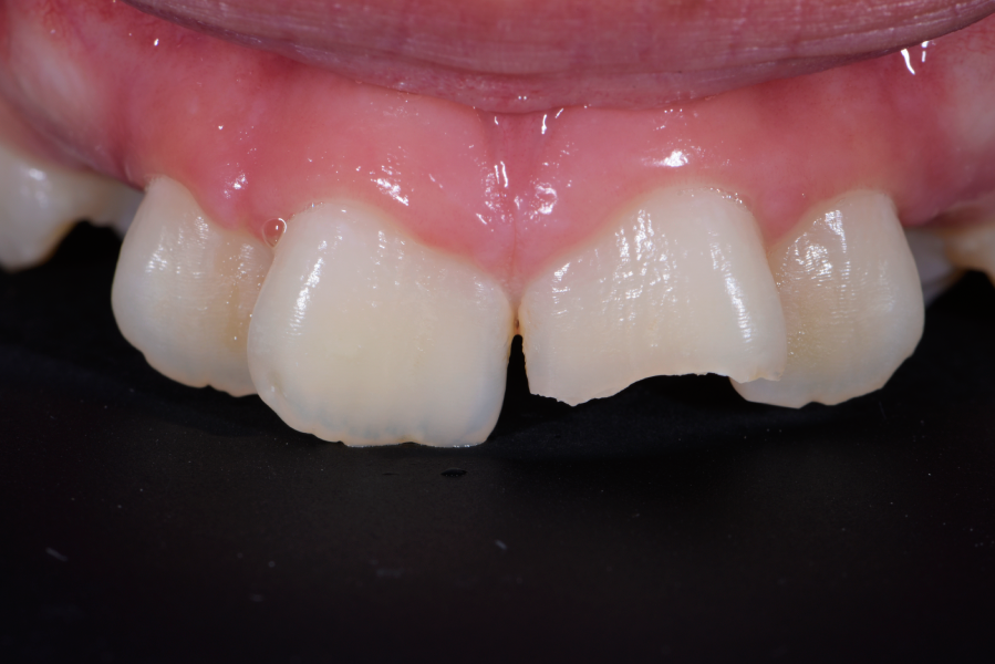 Before