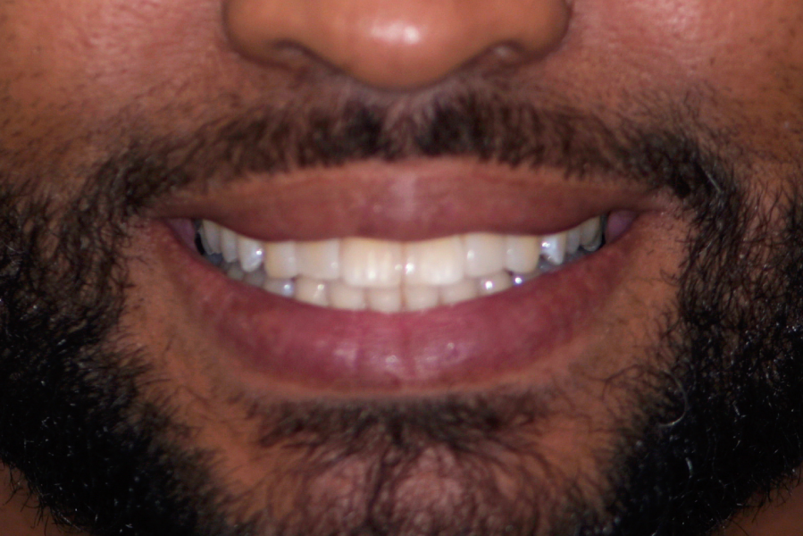 After