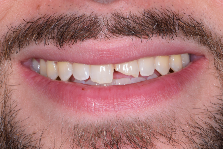 Before