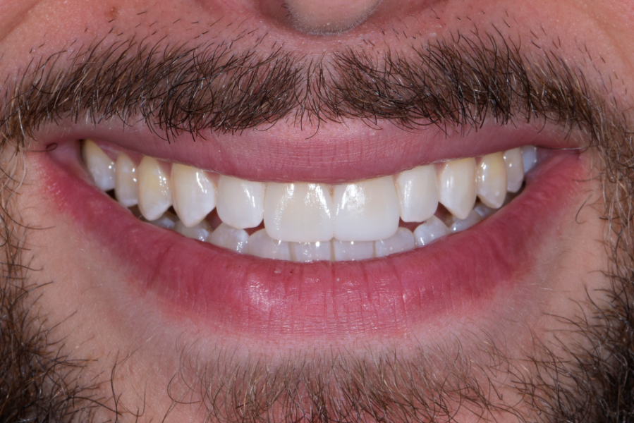 After