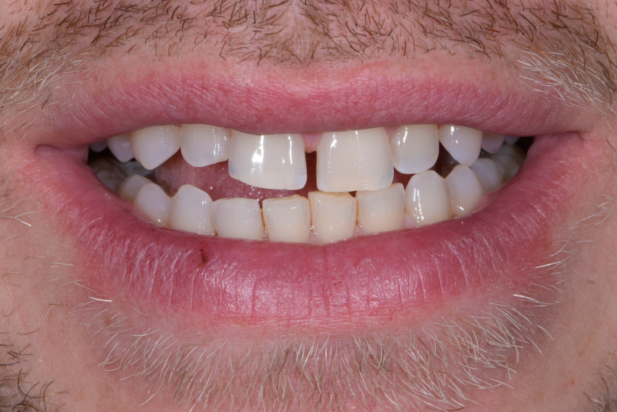 Before