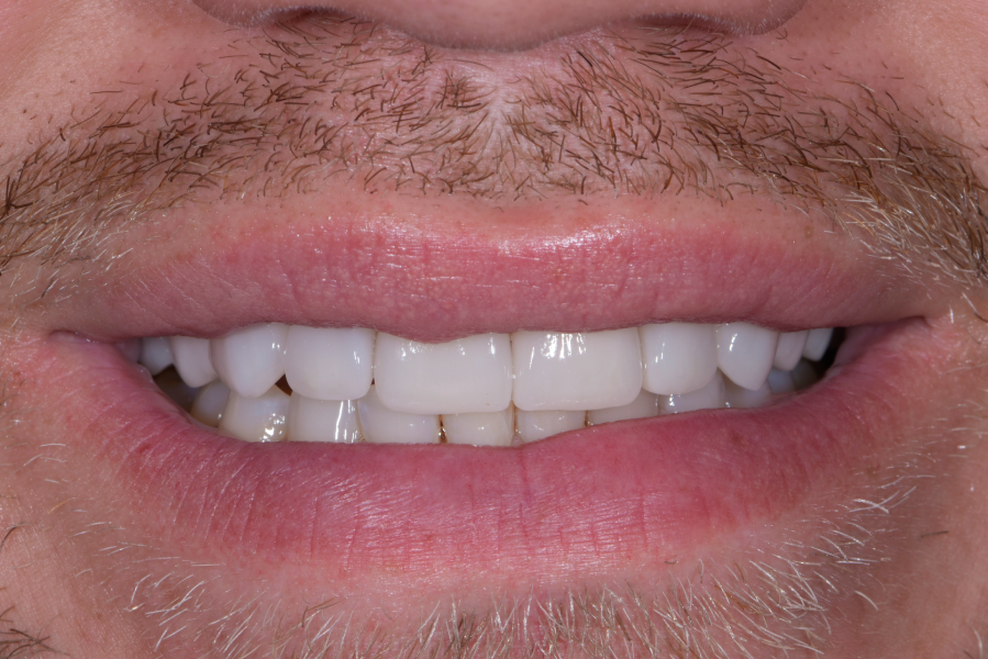 After