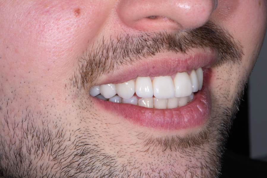 After