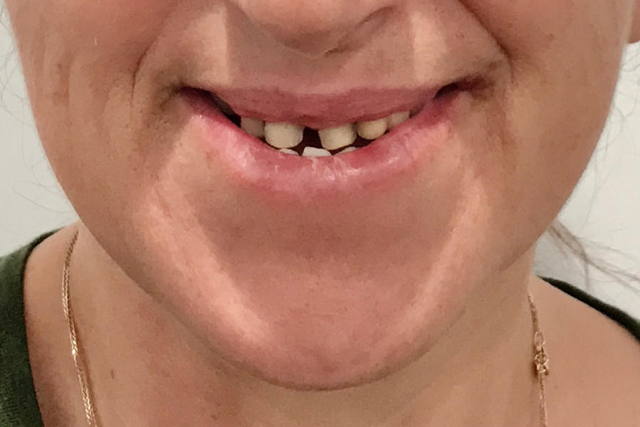 Before